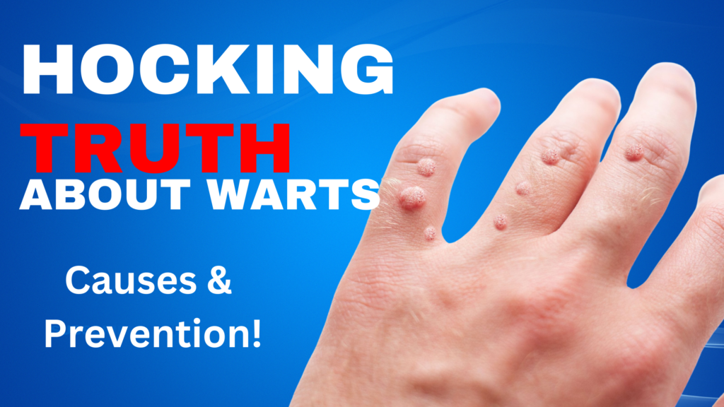causes warts?.