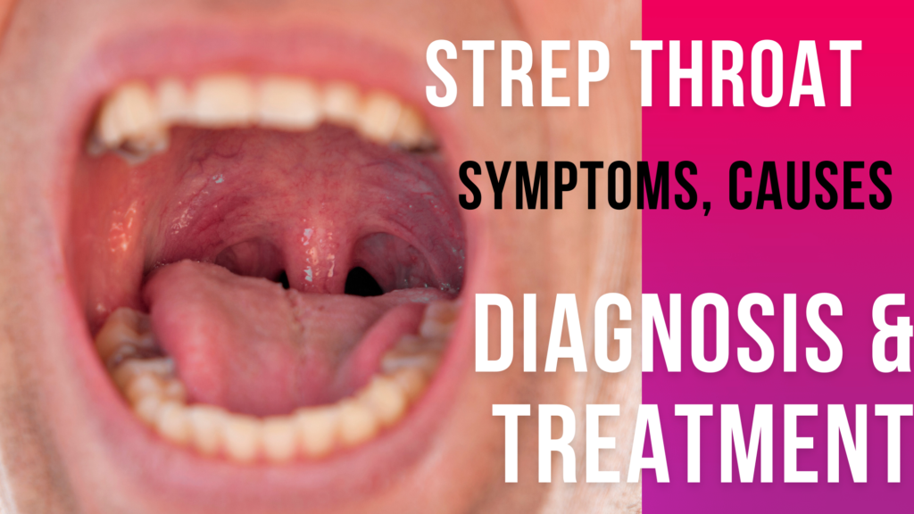 Strep Throat